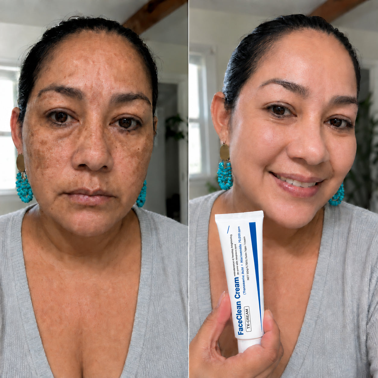FaceClean Cream — corrector de manchas