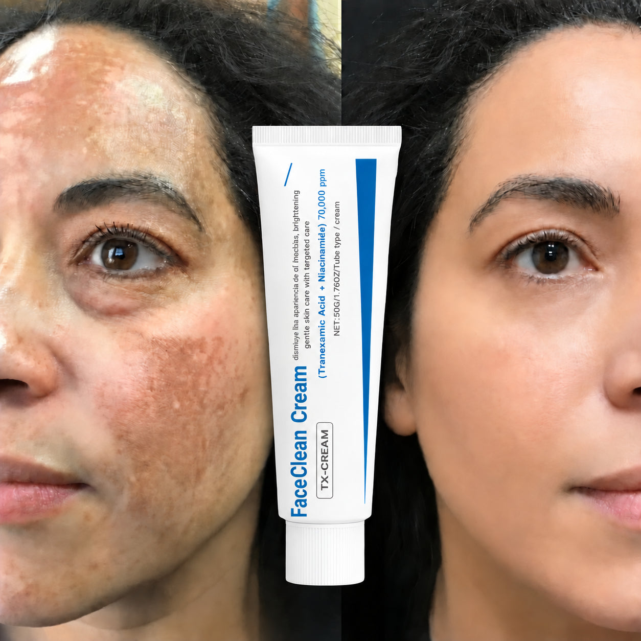 FaceClean Cream® Corrector de Manchas