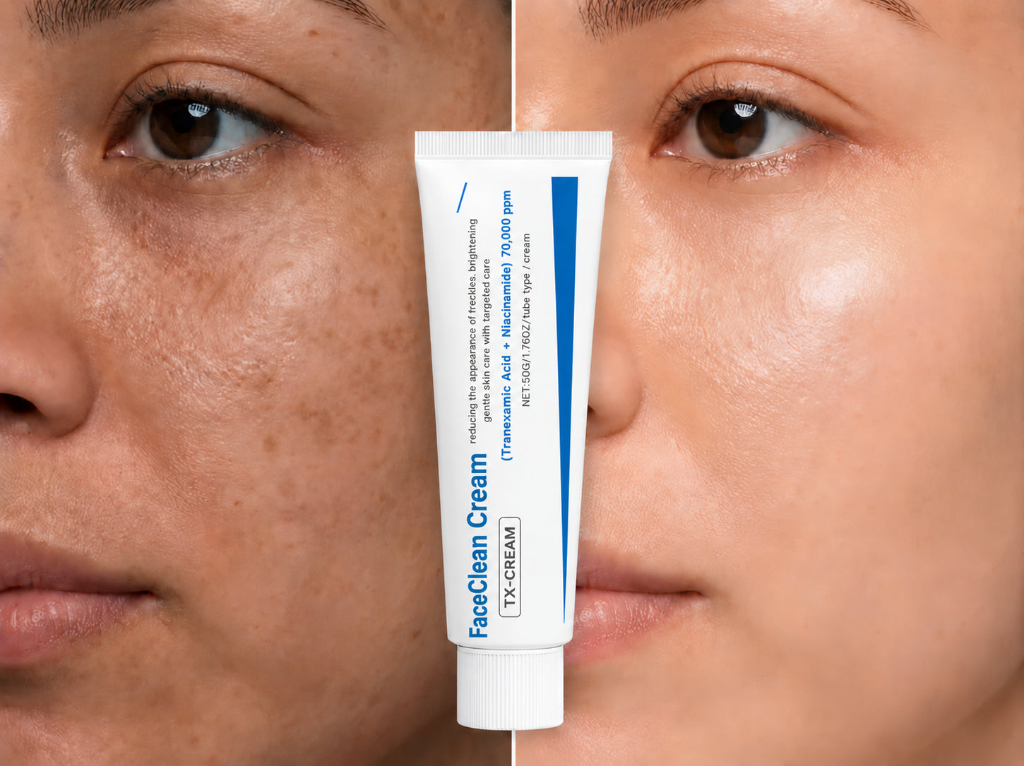 FaceClean Cream — corrector de manchas